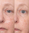 Spaoxy Gel (3 Treatments per Box) - Dr. Medion