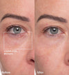 Spaoxy Gel (3 Treatments per Box) - Dr. Medion